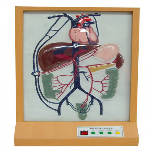  電動門靜脈側支循環(huán)模型